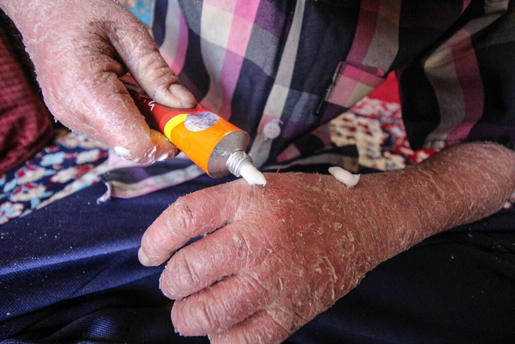 ماجرای رها شدن یک نوزاد پروانه‌ای در بیمارستان