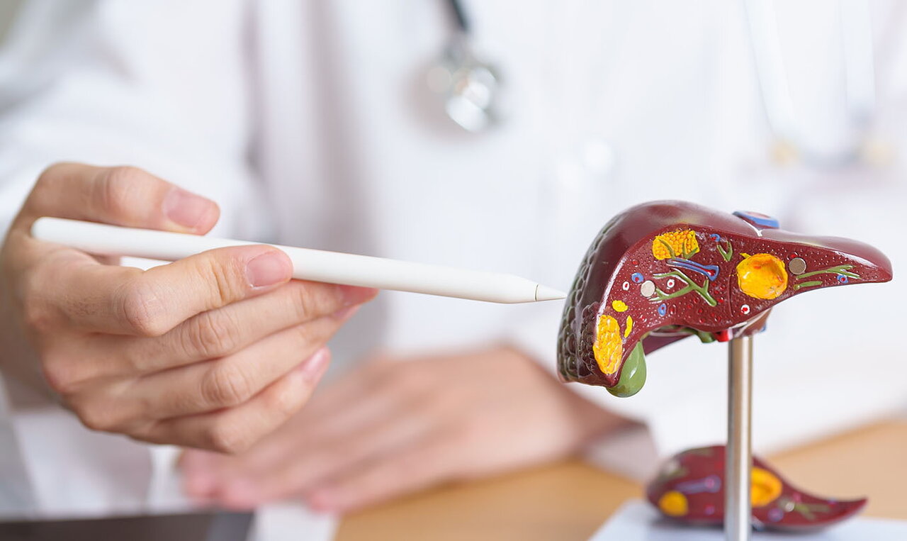 آیا باید از گرید یک کبد چرب ترسید؟/ آنزیم‌های کبدی نرمال، نشانه مبتلا نبودن به کبد چرب؟/ ساده‌ترین روش تشخیص کبد چرب و فیبروز کبدی