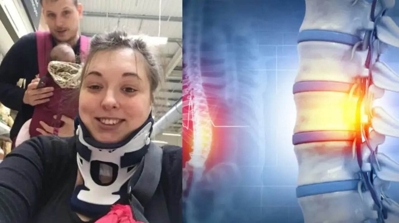 وقتی خمیازه‌ای ساده‌ زندگی را زیر و رو می‌کند/ زنی که خمیازه کشید و روانه بیمارستان شد